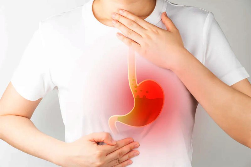 Homeopathic Remedies for Acidity & Digestive Problems | Natural Relief