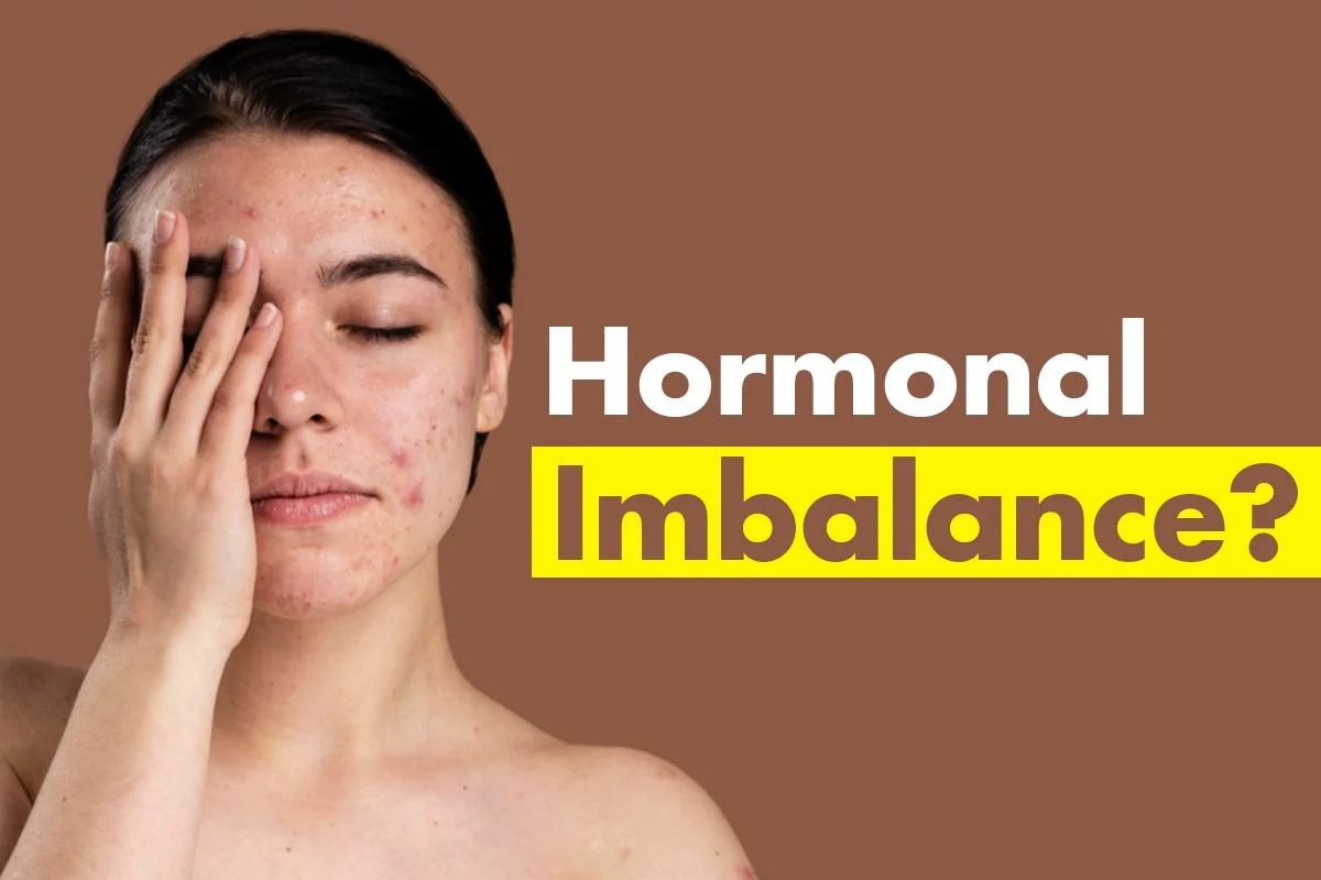 Homeopathic PCOS Remedies: Natural Relief for Hormonal Imbalance